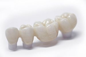 Zirconia full porcelain teeth