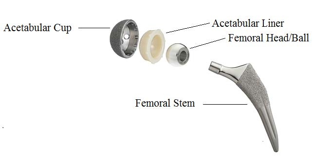 Joint prosthesis